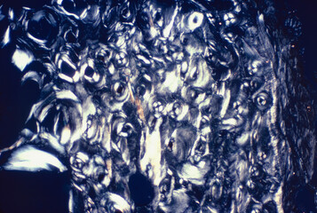 Bone tissue. Polarised light