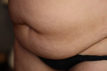 Close-up view of a person's stomach