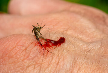 A mosquito bite with blood.Kill the mosquito on the body.Malaria.