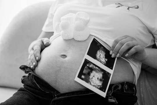 Black and White Pregnancy Announcement with Baby Shoes and Ultrasound Photo Showing Expecting Mother's Belly, Tender Moment, Soft Focus, Gray Tones. - Powered by Adobe
