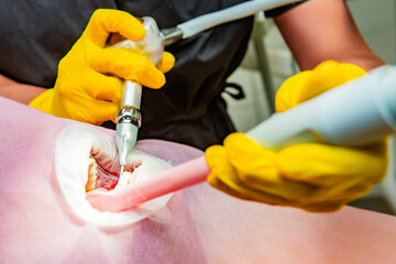 Dentistry. Professional dentist does hardware teeth cleaning with Air Flow for a patient....