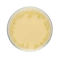 Bacterial colonies in a petri dish
