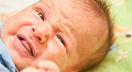 newborn baby lying down. jaundice pimples on skin. close-up portrait