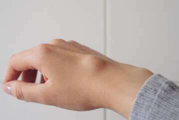 Female right back hand with ganglion cyst on the dorsum,  fluid-filled bump associated with a joint or tendon sheath, close-up view, selected focus.