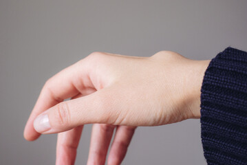 Female right back hand with ganglion cyst on the dorsum,  fluid-filled bump associated with a joint or tendon sheath, close-up view, selected focus.