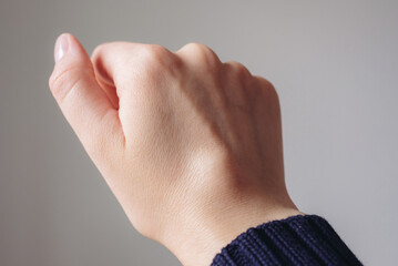 Female right back hand with ganglion cyst on the dorsum,  fluid-filled bump associated with a joint or tendon sheath, close-up view, selected focus.