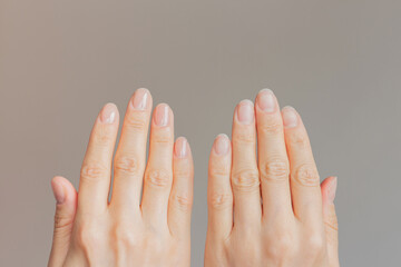 Close-up comparison before and after of a well-groomed female hands with a beautiful nude manicure. 