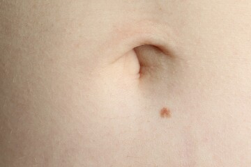 Woman with mole on her skin, macro view