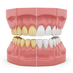 Obraz premium Comparison of yellow and white teeth on dental model