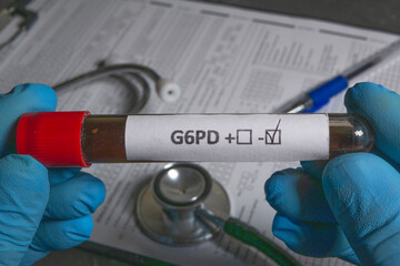 Doctor holding blood sample with positive g6pd test result