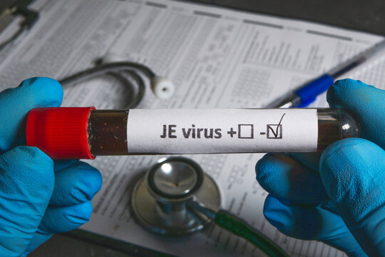 Doctor holding test tube with positive japanese encephalitis virus test result