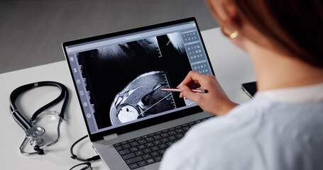 Orthopedic Surgeon Reviews MRI On Computer At Radiology Desk