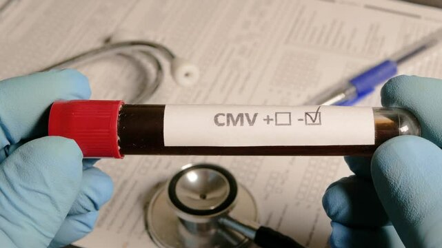 Doctor holding blood sample, cmv positive test result