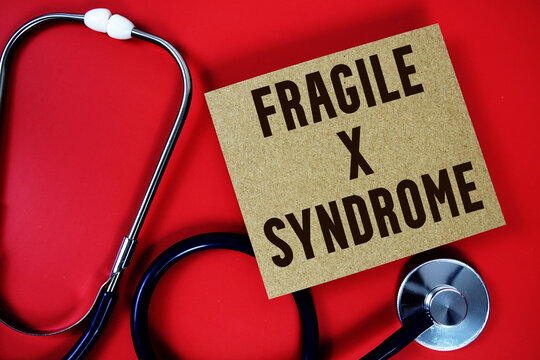 Fragile X Syndrome text written on paper card with stethoscope on red background