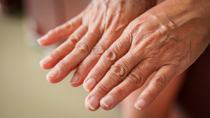 Close up hands finger senior woman. Life body care old hand nails adult person. Closeup anatomy...