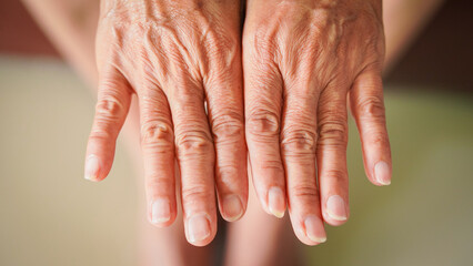 Close up hands finger senior woman. Life body care old hand nails adult person. Closeup anatomy fingers elderly aged. Retirement patient. Visit mature people. Female wrinkled. Wellness health care 