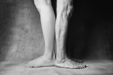 Comparison of the legs of a young and old woman. Varicose veins on a female legs. Youth and old age. The concept of comparison of youth and old age. Toned image, black and white image