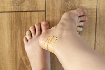 Shoe calluses on woman's feet. Bactericidal medical patches closeup. Soft focus