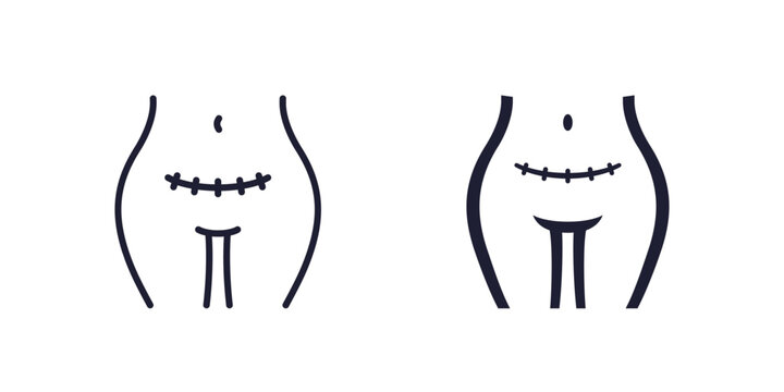 cesarean section icon with scar, line and solid design
