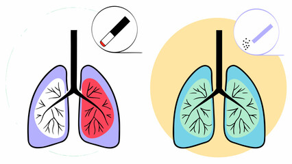 Comparison of Smoker’s Lungs and Healthy Lungs Anti-Smoking Vector Illustration