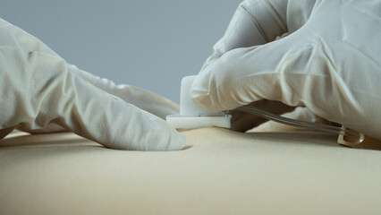 Sterile-gloved hands inserting a Huber (gripper) needle into a simulated subcutaneous port. Side...