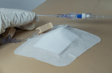 Gripper (Huber) needle connected to IV tubing and non-return cap over a port-a-cath site, covered...
