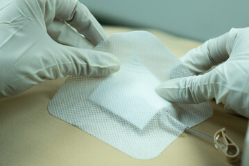 Sterile-gloved hands applying an opaque dressing over a Huber (gripper) needle on a simulated...