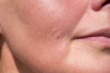 Realistic close-up of mature woman’s cheek and lip area highlighting skin texture, fine lines,...