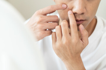 Asian men worry about acne on their faces when looking in the mirror