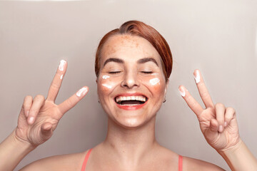 Happy caucasian woman face with pigmentation, melasma, freckles, age spots photo. Woman uses facial...