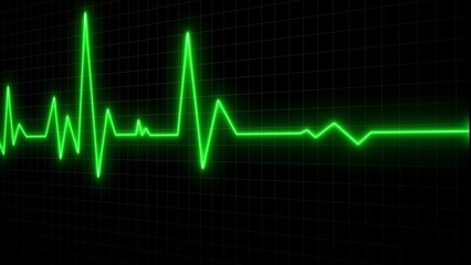 A neon green heartbeat displayed on a black grid signifying medical health and life