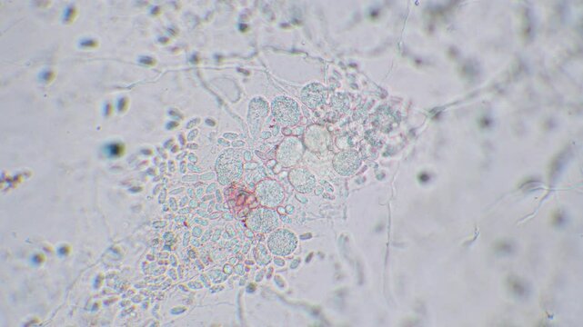 Freshly hatched germinated slime mold spores to amoeba between other spores