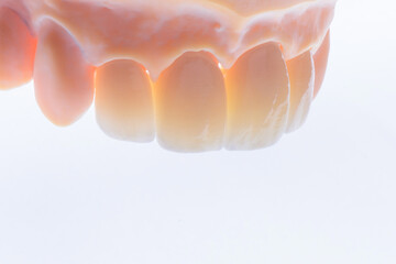 High-quality four dental crowns made of zirconium for fixation to the frontal teeth of upper jaw.