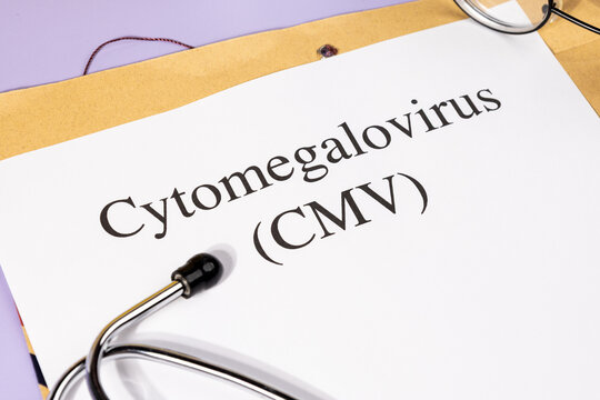 A Paper with &ldquo;CMV Virus&rdquo; Title in Clipboard Set on the Desk with Stethoscope &ndash; Cytomegalovirus Infection Concept