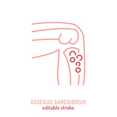 Osseous sarcoidosis icon. Editable vector illustration showing granulomatous inflammation