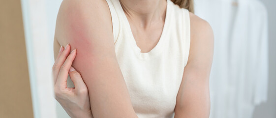 skin problem and beauty. Young woman scratch body has itchy skin from skin allergic, steroid...