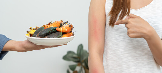 food allergies, women point on red skin occur from itching and redness after eating sea food,...