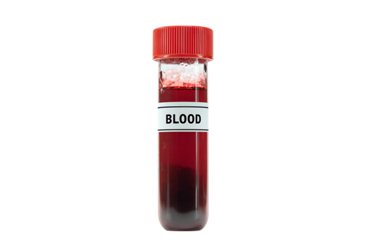 A sample of blood in a test tube. - Powered by Adobe