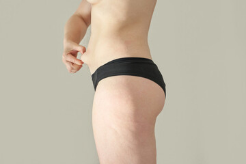 Young caucasian female pinching skin on waist in black underwear showing body awareness.