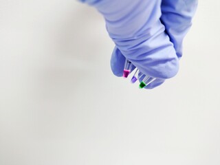 scientist holding microtubes containing colorful solutions