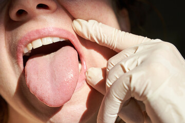 Close-up of female mouth with tongue out and gloved hand examining inside oral health check.
