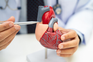 Cardiovascular disease CVD, Asian doctor holding human anatomy model for learn and treat heart...