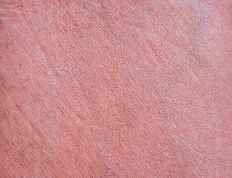 Human skin