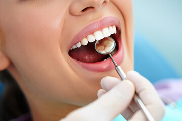 Obraz premium Close up of a patient s mouth during a dental examination with a mirror