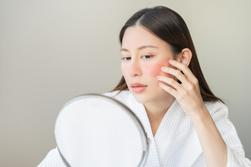 Dermatology, scratch asian young woman looking at mirror, expression worry and itch, itchy allergy...