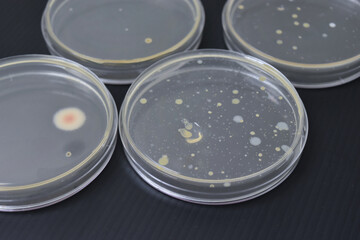 Colonies of bacteria growth on agar plate medium in laboratory.	