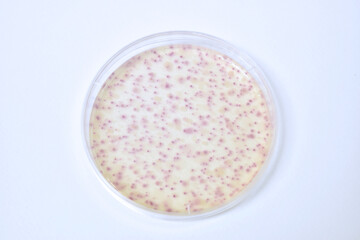 Colonies of bacteria growth on agar plate medium in laboratory.	