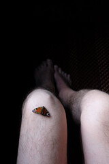 Dead Butterfly on the Person’s Pale, Hair-covered Knee in a Dimly Lit Space. Life's Transience,...