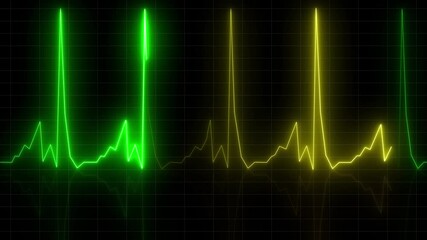 Abstract heartbeat and pulse rate signal technology , Electrocardiogram show heart beat line icon animated on grid background. - Powered by Adobe