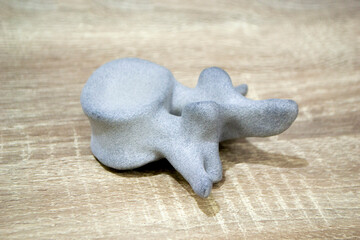 Prototype model of human vertebra 3D printed from polyamide powder. Three-dimensional model printed...